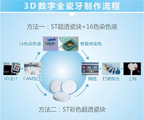 口腔专区项目详情 数字内容制作服务全面解析